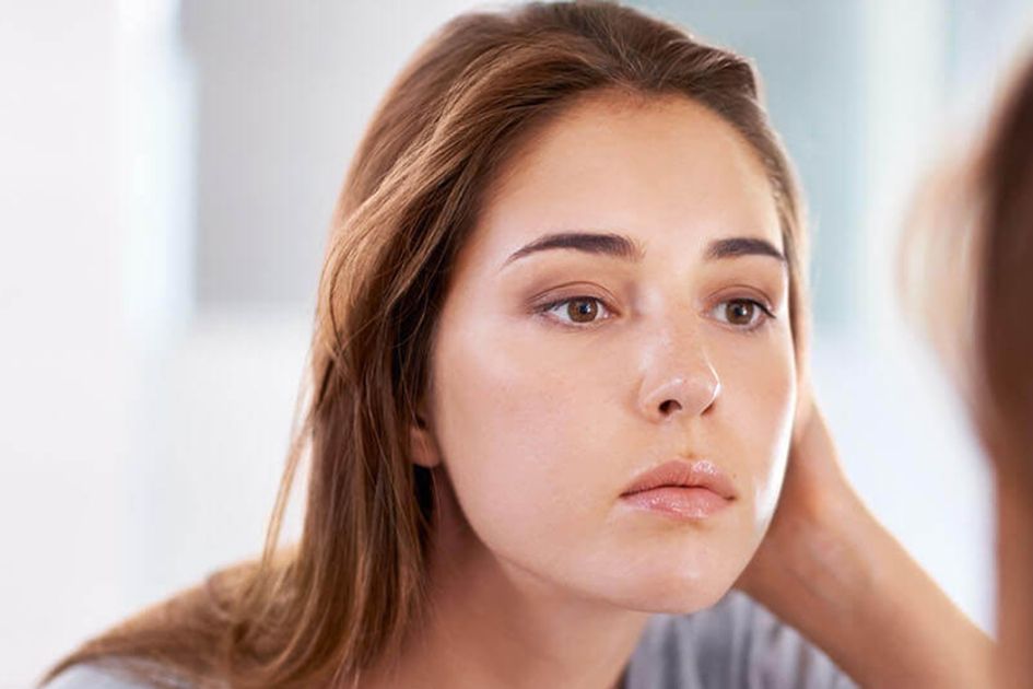 cara mengatasi muka berminyak secara alami